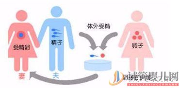 试管婴儿具体流程(图1)