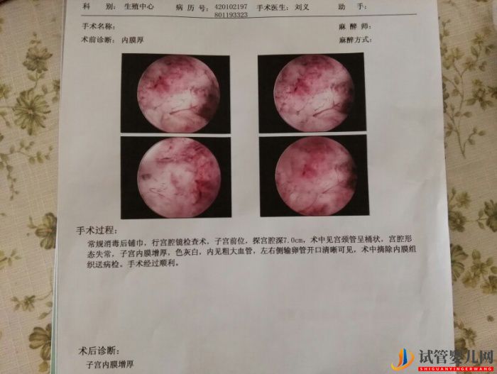​试管胚胎移植失败后做宫腔镜检查有意义吗？(图1)