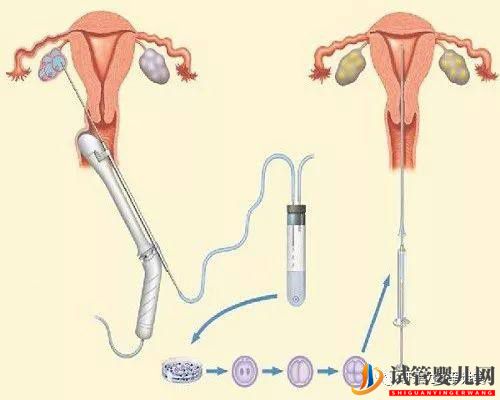 试管婴儿的一个基本流程和周期时间(图4) 试管婴儿的一个基本流程和周期时间(图4)