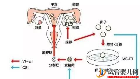 试管婴儿的历史及其发展过程(图8) 试管婴儿的历史及其发展过程(图8)