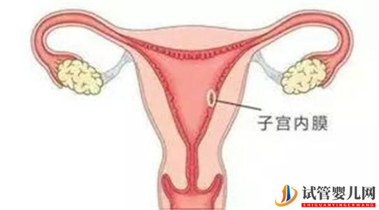 做俄罗斯试管婴儿需要调理内膜吗?调内膜一般要多少天(图1) 做俄罗斯试管婴儿需要调理内膜吗?调内膜一般要多少天(图1)