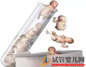 三代美国试管婴儿有哪些区别(图1) 三代美国试管婴儿有哪些区别(图1)