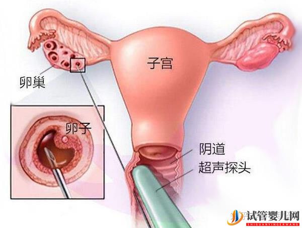 美国试管专家提高试管成功率的有效方案(图7) 美国试管专家提高试管成功率的有效方案(图7)