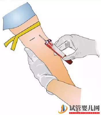 试管周期是什么意思_一个周期要多久(图4) 试管周期是什么意思_一个周期要多久(图4)