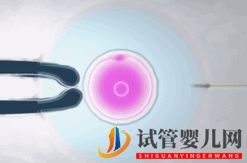 做试管婴儿到底要花多少钱_几万和十几万有什么区别(图10) 做试管婴儿到底要花多少钱_几万和十几万有什么区别(图10)