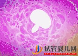 做试管婴儿到底要花多少钱_几万和十几万有什么区别(图12) 做试管婴儿到底要花多少钱_几万和十几万有什么区别(图12)