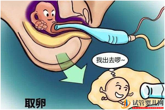 很多人都忽略了大龄做试管婴儿的这些好处(图1) 很多人都忽略了大龄做试管婴儿的这些好处(图1)