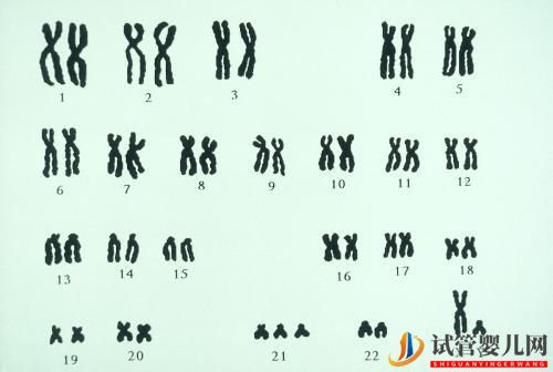 夫妻染色体正常，试管胚胎染色体异常的三个原因你都知道吗？(图1)