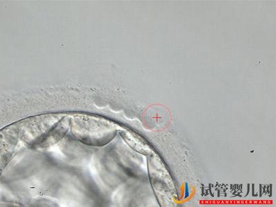 试管婴儿网:哪些食物能提高试管婴儿备孕成功率(图2) 哪些食物能提高试管婴儿备孕成功率(图1)