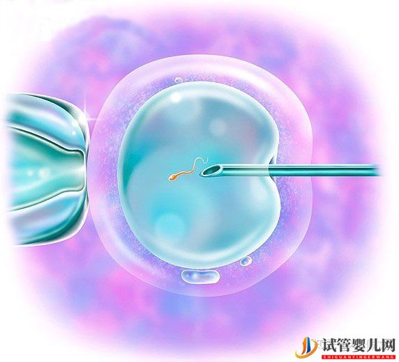 一、二、三代试管婴儿的优缺点,做试管婴儿应该选择(图2)