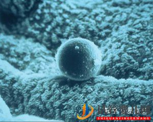 论决定三代试管成功率5大因素之子宫内膜(图4) 论决定三代试管成功率5大因素之子宫内膜(图4)