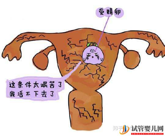 做泰国试管婴儿要满足哪些条件(图2) 做泰国试管婴儿要满足哪些条件(图2)