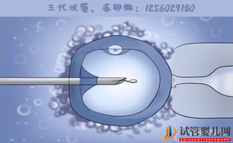 三代试管婴儿在泰国是合法的吗(图1) 三代试管婴儿在泰国是合法的吗(图1)
