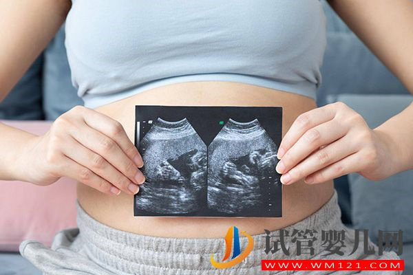 胚胎出现16号染色体三体的原因有4点，是偶然or遗传来看(图2)