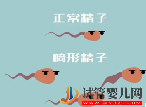 image.png 精子头部畸形有什么影响,胎儿会产生畸形吗?81次阅读(图1)