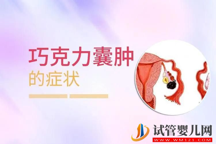 巧克力囊肿有哪些症状?会引起不孕吗?(图1) 巧克力囊肿有哪些症状?会引起不孕吗?(图1)