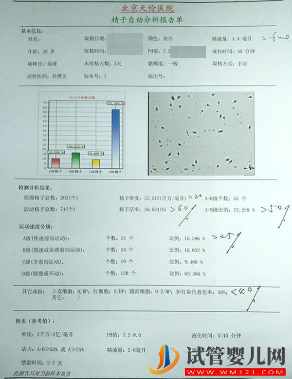常规精液检查(图1) 常规精液检查(图1)