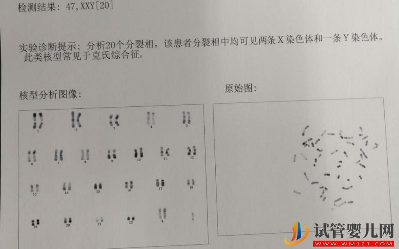 男性染色体异常是可以做试管婴儿的吗?(图1) 男性染色体异常是可以做试管婴儿的吗?(图1)
