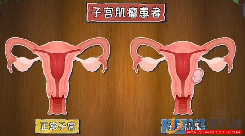 影响试管婴儿成功率的子宫内环境有哪些(图2) 影响试管婴儿成功率的子宫内环境有哪些(图2)