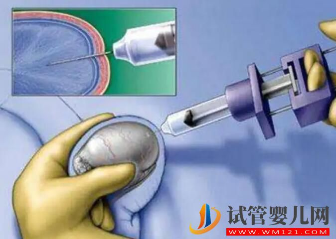 男性不孕隐蔽问题,精子DNA断裂怎么办?(图2) 男性不孕隐蔽问题,精子DNA断裂怎么办?(图2)