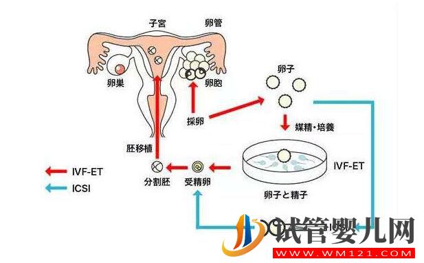 试管婴儿移植后胚胎着床是什么感觉?(图1) 试管婴儿移植后胚胎着床是什么感觉?(图1)