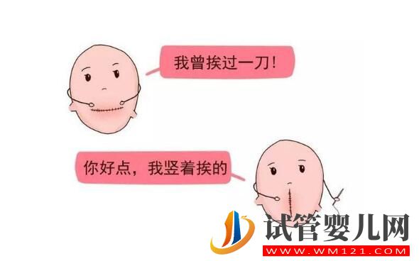 女人多少岁后不能做试管婴儿?(图4) 女人多少岁后不能做试管婴儿?(图4)