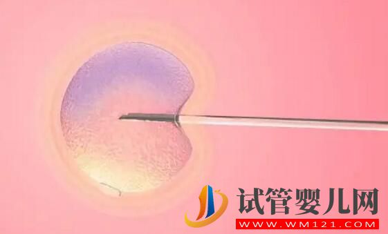 看完这个攻略,让你做试管婴儿少走弯路又省钱!(图1) 看完这个攻略,让你做试管婴儿少走弯路又省钱!(图1)
