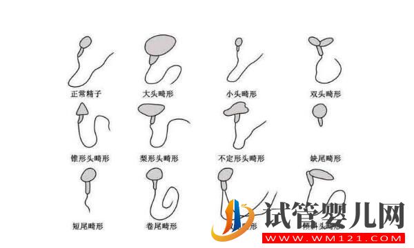 试管婴儿是用老公的精子吗?(图2) 试管婴儿是用老公的精子吗?(图2)