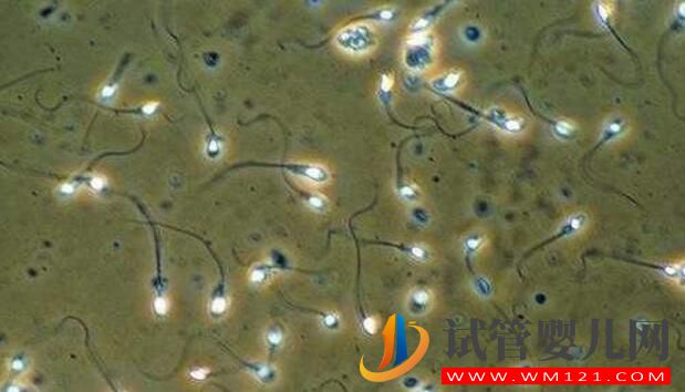 试管婴儿是用老公的精子吗?(图4) 试管婴儿是用老公的精子吗?(图4)