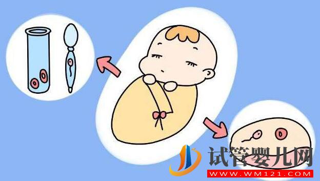 高龄妇女为什么要选择试管婴儿?(图3) 高龄妇女为什么要选择试管婴儿?(图3)