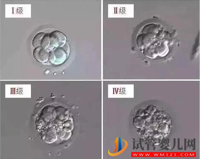 试管婴儿胚胎选择看“颜值”,长得好看才能被移植!(图4) 试管婴儿胚胎选择看“颜值”,长得好看才能被移植!(图4)