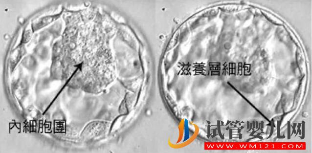 试管婴儿胚胎选择看“颜值”,长得好看才能被移植!(图5) 试管婴儿胚胎选择看“颜值”,长得好看才能被移植!(图5)