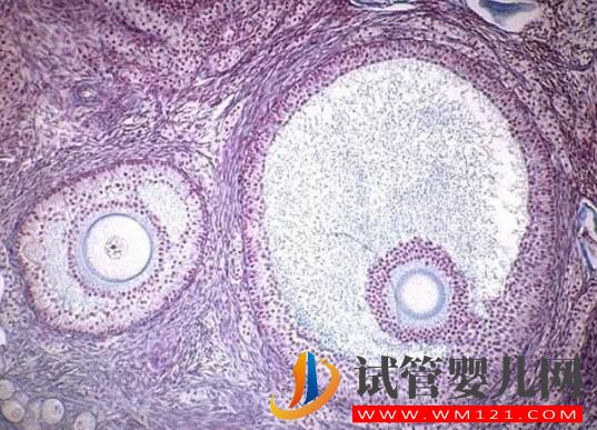 试管婴儿取卵时空卵泡B超能看出来吗?(图2) 试管婴儿取卵时空卵泡B超能看出来吗?(图2)