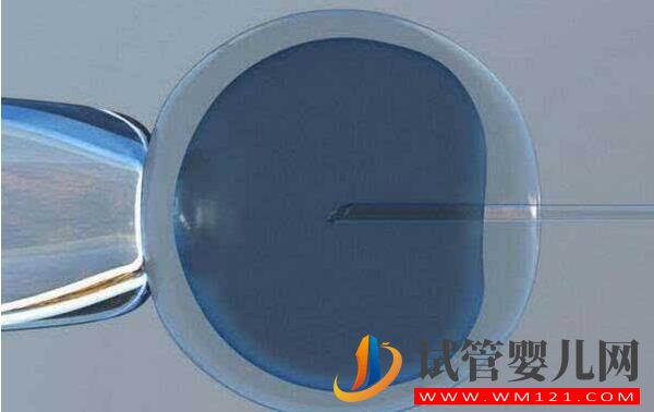 哪些情况会建议做试管?做试管婴儿缓解压力的方式(图3) 哪些情况会建议做试管?做试管婴儿缓解压力的方式(图3)