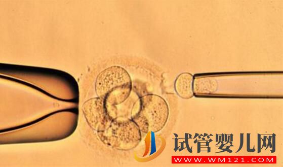 解答做试管婴儿的人非常担心的几个问题(图6) 解答做试管婴儿的人非常担心的几个问题(图6)
