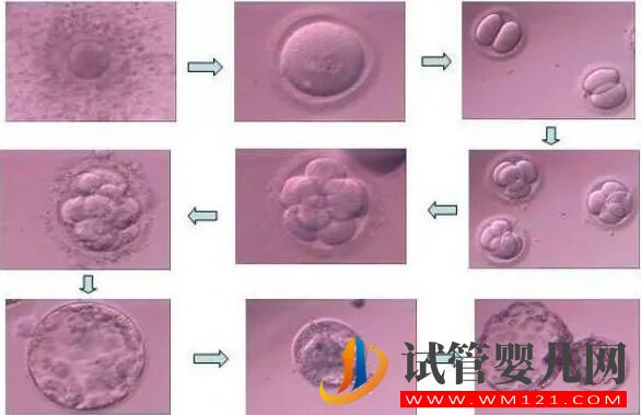 胚胎碎片率的变化对试管婴儿意味着什么(图2) 胚胎碎片率的变化对试管婴儿意味着什么(图2)
