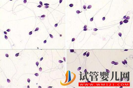 胚胎碎片率的变化对试管婴儿意味着什么(图4) 胚胎碎片率的变化对试管婴儿意味着什么(图4)