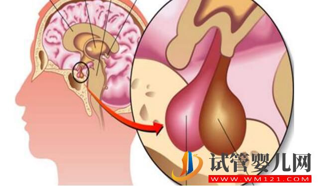 泌乳素高会影响做试管婴儿吗?如何比较好?(图1) 泌乳素高会影响做试管婴儿吗?如何比较好?(图1)