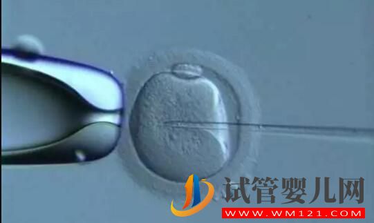 试管婴儿做一代好还是二代好?(图2) 试管婴儿做一代好还是二代好?(图2)