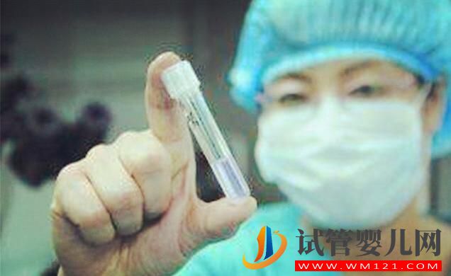 试管婴儿对男方精子有什么要求,快来记下吧(图2) 试管婴儿对男方精子有什么要求,快来记下吧(图2)