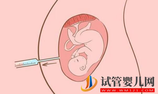 女性40岁适合做试管婴儿吗？做试管需要注意什么(图3)