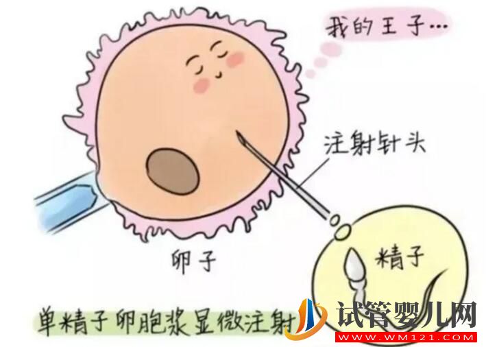 国内试管婴儿全过程和试管注意事项介绍(图2) 国内试管婴儿全过程和试管注意事项介绍(图2)