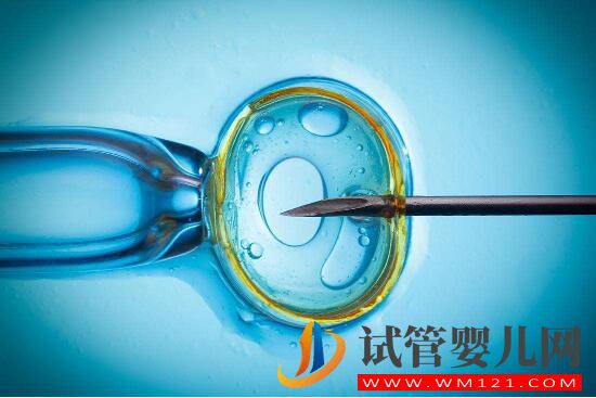 做试管婴儿的流程有哪些 手术费用包括哪些方面(图1) 安顺做试管婴儿的流程有哪些 手术费用包括哪些方面(图1)