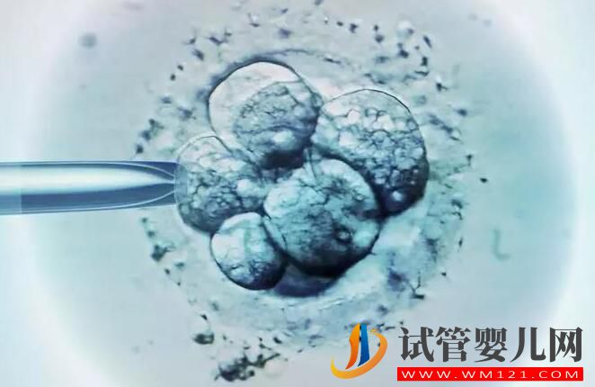 适合做试管婴儿的人群有哪些?试管成功率受什么影响?(图4) 适合做试管婴儿的人群有哪些?试管成功率受什么影响?(图4)