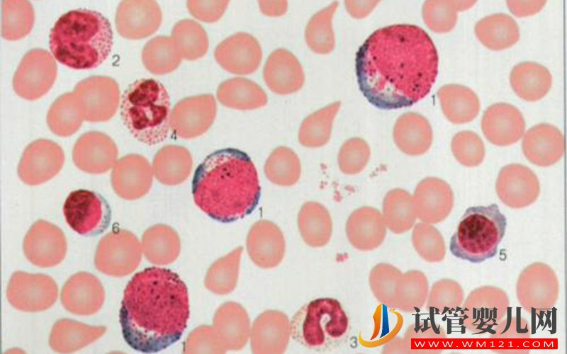在美国les用骨髓技术生孩子要多少钱?(图1) 在美国les用骨髓技术生孩子要多少钱?(图1)