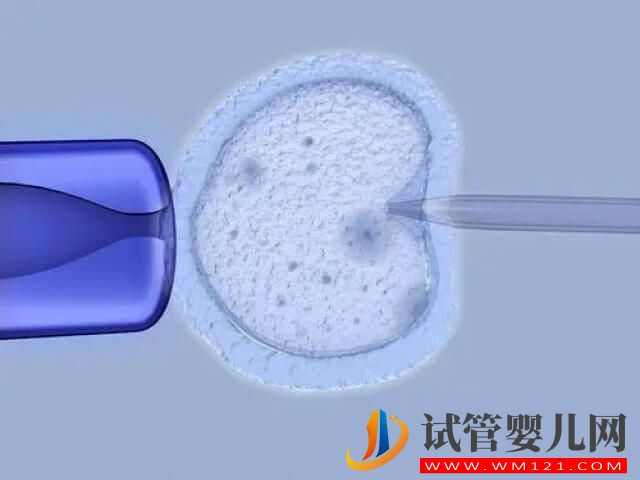 试管促排后取卵泡数量越多手术费用就越高吗?(图1) 试管促排后取卵泡数量越多手术费用就越高吗?(图1)