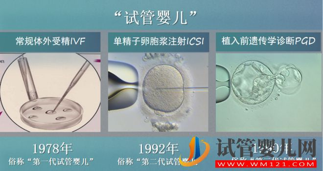 试管婴儿技术走到了哪一步？(图7)
