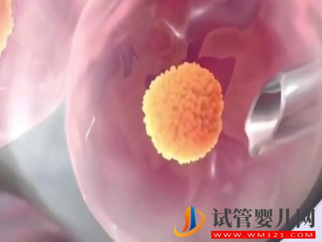 在石家庄做一次试管婴儿大概需要多少钱?(图2) 在石家庄做一次试管婴儿大概需要多少钱?(图2)