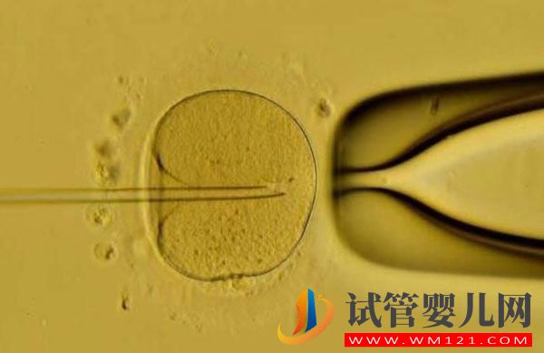 试管婴儿鲜胚移植成功率高吗?哪些情况不能移植鲜胚(图1) 试管婴儿鲜胚移植成功率高吗?哪些情况不能移植鲜胚(图1)