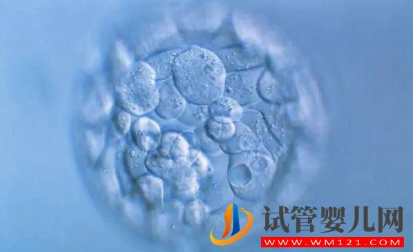 试管婴儿胚胎移植前、后都有哪些注意事项和常见的问题(图2) 淄博试管婴儿胚胎移植前、后都有哪些注意事项和常见的问题(图2)
